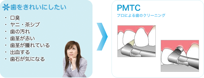 歯をきれいにしたい→PMTC